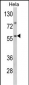 SARS2 Antibody (Center)